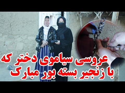 عروسی سیاموی یا معصومه دختر که با زنجیر بسته بود حقیقت دارد یا نه! چرا سیاموی عروسی کرد؟ 