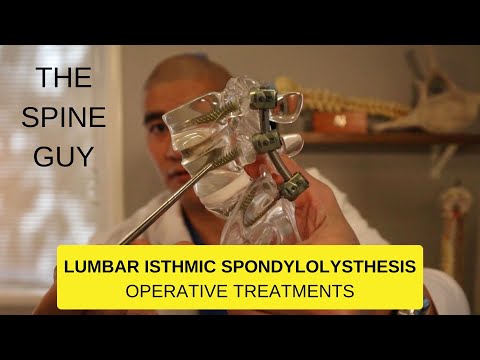 Lumbar Isthmic Spondylolisthesis - Part 3 - Surgical Treatments