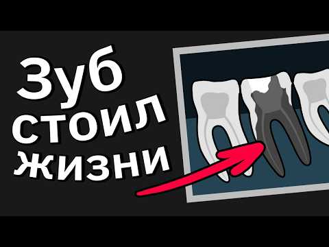 Врачи Сливают Моменты "Чёрт, Всё Намного Хуже, Чем Я Думал"