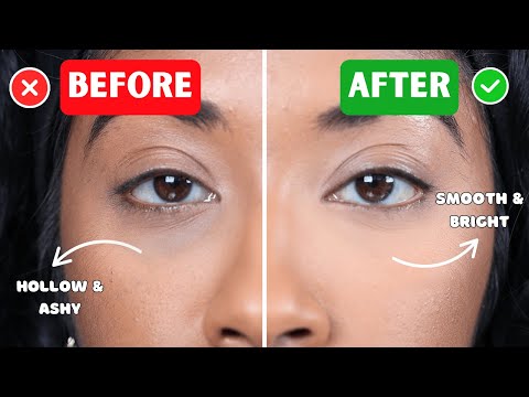 STOP COVERING DARK CIRCLES THE WRONG WAY‼️ (try this instead)