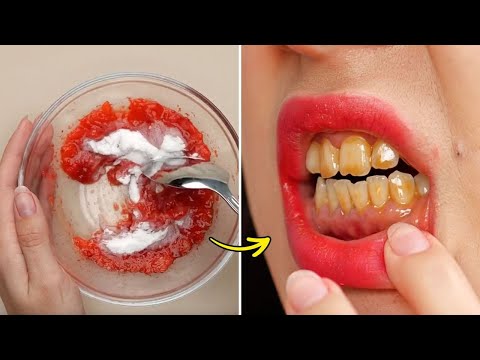 20+ DIY Natural Remedies You Can Make at Home to Solve Common Beauty Problems