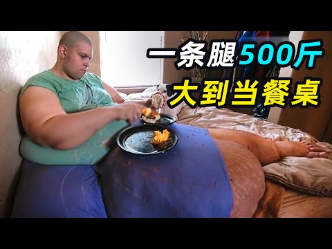 32岁巨婴体重810斤，差点压死女友，惨遭分手