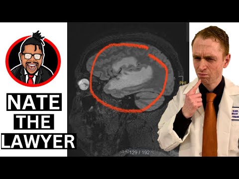 Neurologist Explains Nate the Lawyer's Brain Tumor