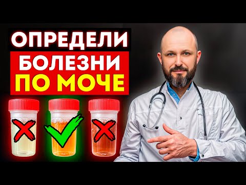 Ваши почки – НЕ В ПОРЯДКЕ! / О чем говорит ЦВЕТ МОЧИ?