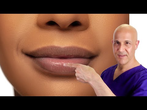 How to Plump Your Lips Naturally! Dr. Mandell