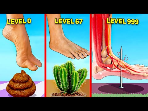 When taking a step causes unlimited pain