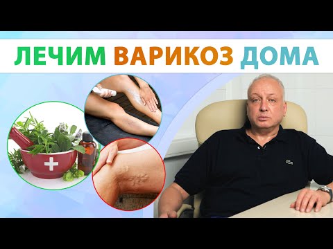 How to treat varicose veins? What should you avoid?