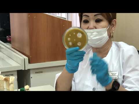 Определение чувствительности микроорганизмов к антибиотикам