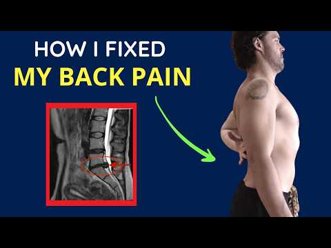 THIS Decision Healed My Back Pain without Surgery