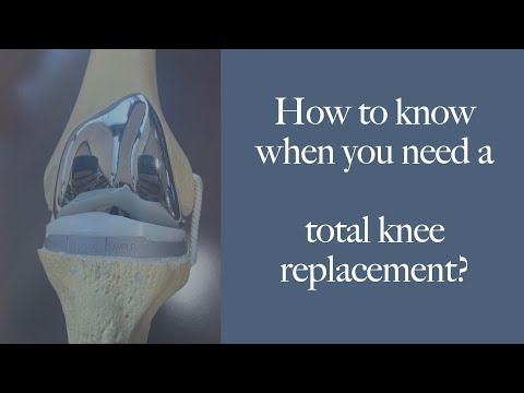 BEST REASONS to get a TOTAL KNEE replacement. How to know when & if you should have surgery