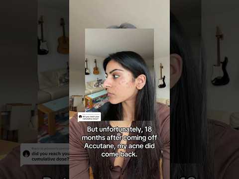 My acne still came back after reaching my cumulative dose on accutane 😔 #skincare #acne #accutane