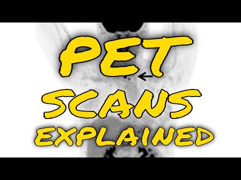 How do  PET scans work to detect things such as cancer?