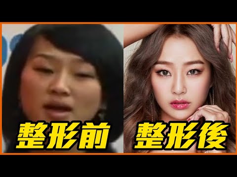 16位霸氣承認整形的韓星！ 《社內相親》薛仁雅鼻子以前超大