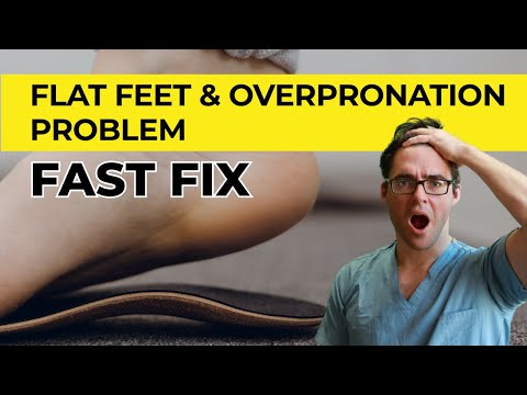 Reverse Flat Feet & Overpronation FAST [FIX Knee, Hip & Back Pain]