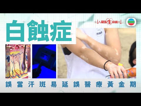 最強生命線|白蝕症 (繁 / 簡字幕)|醫療|治療|中醫|無綫新聞|TVB News