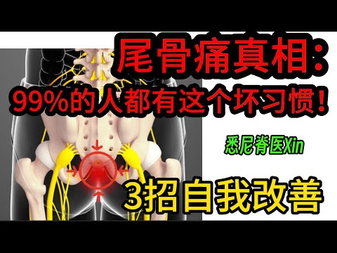 尾骨痛真相：99%的人都有这个坏习惯！3招缓解尾骨痛｜悉尼脊医Xin