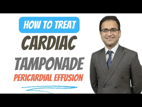 Pericardial Effusion (Cardiac Tamponade) Medicine Lecture on Treatment, Pathology, USMLE NEETPG