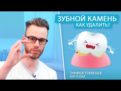 Как удалить зубной камень. Можно ли убрать в домашних условиях?