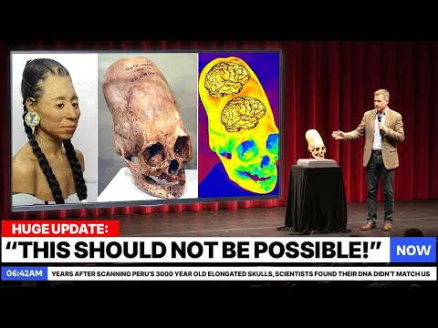 After Scanning Peru’s 3000 Year Old Elongated Skulls, Scientists Found Their DNA Didn’t Match Us