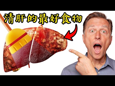 清肝、 保護肝的最佳6類食物，自然療法,柏格醫生 Dr Berg