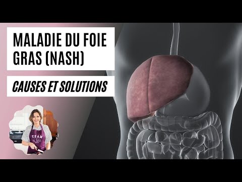 NASH : stéatose hépatique (foie gras) / causes et solutions