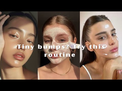 Tiny Bumps on Your Face? It’s Not Acne — Here’s What to Do 💧