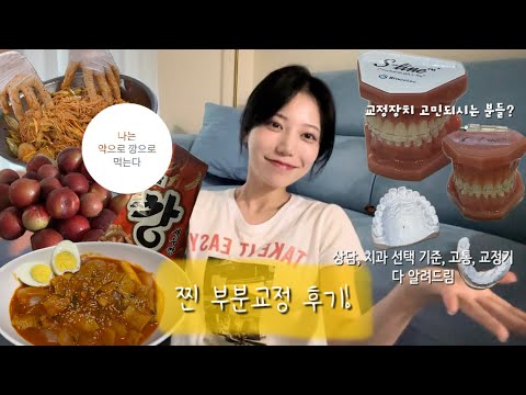 [일상브이로그]부분교정 후기 찾고 계시죠? | 1-10일차 교정 후기 | 교정 브이로그 | 근데 또 먹는게 반절...