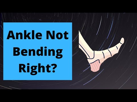 Stiff Ankle from Boot/Cast? 5 PERFECT Stretches to QUICKLY RESTORE your MOBILITY