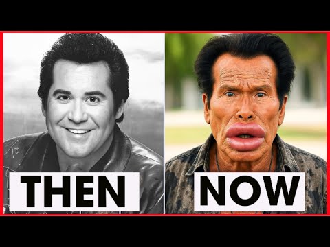 Most UNBELIEVABLE Plastic Surgery of Male Hollywood Celebrities (Then and Now)