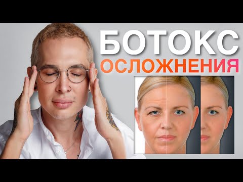 БОТОКС ОСЛОЖНЕНИЯ #ботокс