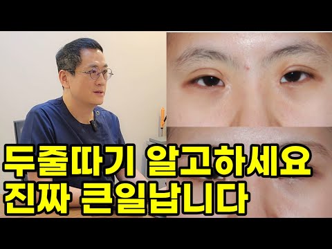 전문의가 정말 솔직하게 밝히는 쌍꺼풀재수술 두줄따기 알고 하셔야 합니다(부작용,실패,붓기,흉터,겹주름,후기)