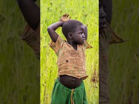 Why Is Burundi Poorest Country In Africa🇧🇮