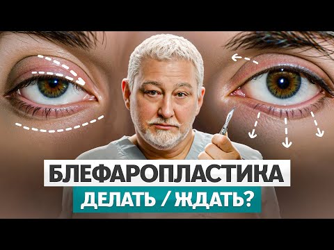 Блефаропластика — как понять, нужна ли пластика век