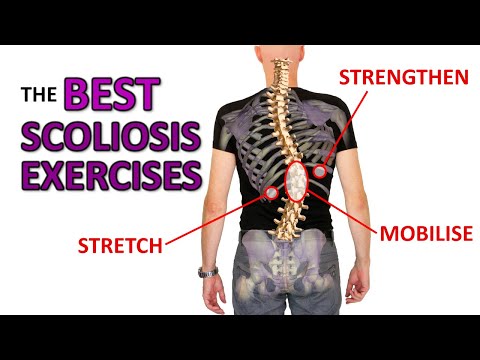 THE Best Exercises For Scoliosis