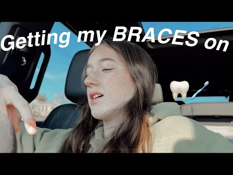 Getting my braces on VLOG!