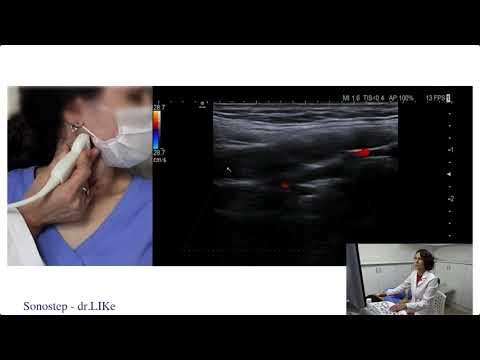 Вебинар - ультразвуковая диагностика артерий шеи