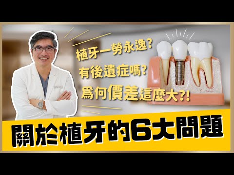 【植牙 #10】植牙費用差距這麼大？植牙會有後遺症嗎？萬一植牙失敗怎麼辦！？關於人工植牙的6大問題，讓楊醫師一次帶你了解｜【祐民牙醫－隱適美旗艦店】鑽石級楊大為醫師 #根管治療 #蛀牙 #拔牙