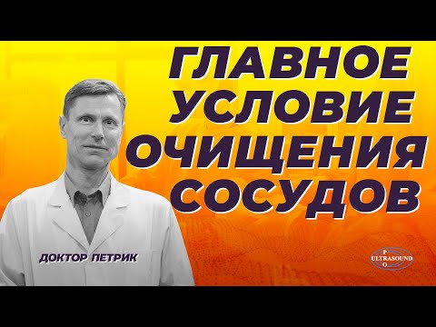 Доказательная медицина: как уменьшить и стабилизировать атеросклеротические бляшки.