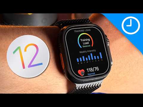 Your Apple Watch Is About to get WAY Smarter – WatchOS 26 Expectations & Rumors