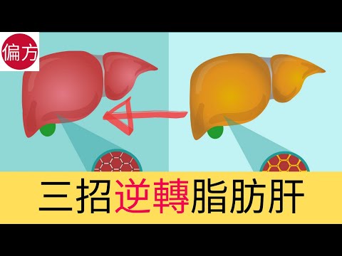 脂肪肝逆轉方法