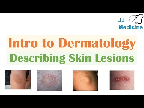 Introduction to Dermatology | The Basics | Describing Skin Lesions (Primary & Secondary Morphology)