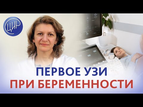 Первое УЗИ при беременности. Когда делать первое УЗИ и первую допплерометрию при беременности?