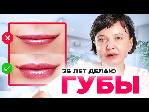 Увеличение губ филлерами гиалуроновой кислоты. Как увеличить губы без последствий | Ирина Рахова