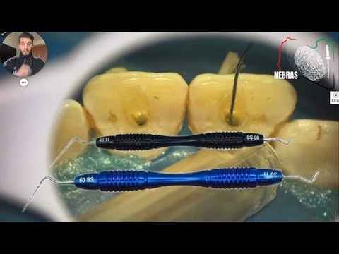 المحاظرة الي يحتاجها كل طبيب أسنان عن MTA وراح تفيده كلش مقدمة من قبل دكتور نبراس الدهاش (الجزء 1)