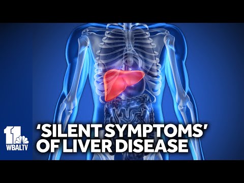 Liver disease can manifests with 'silent symptoms'