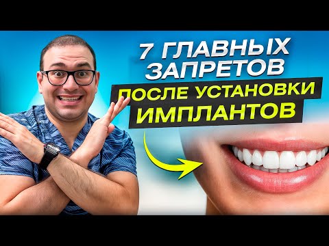Что НЕЛЬЗЯ делать после имплантации зубов? 7 Главных Запретов, Которые Спасут Вашу Улыбку!!