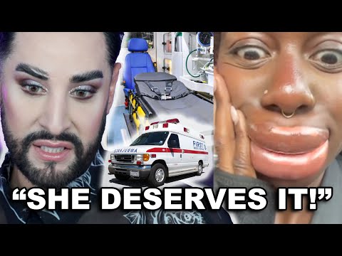 Lip filler horror story makes internet crazy!! 