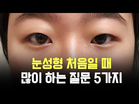 비슷한 눈의 구조 가지신 분들은 공감하실 거예요.