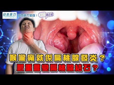 喉嚨痛就係扁桃腺發炎？ 嚴重會變扁桃腺結石？｜ 日本命力呈獻: 健康關注組 ｜ EP395 ｜ 扁桃腺發炎 ｜ 扁桃腺結石 ｜ 敖嘉年 ｜ 黃芳雯 ｜ HOY TV 77台