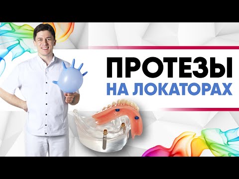 Съёмный протез на локаторах на имплантах [ локатор - замок, удерживающий съёмные зубные протезы ]